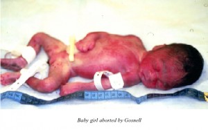 One of the babies found by investigators at Gosnell's abortion facility.