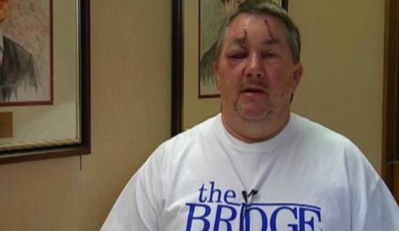 Ohio Pastor Viciously Beaten By Militant Atheist