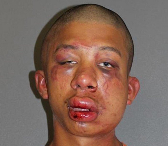 ‘Send an Ambulance’: Father Beats Homosexual Man Caught Raping 11-Year-Old