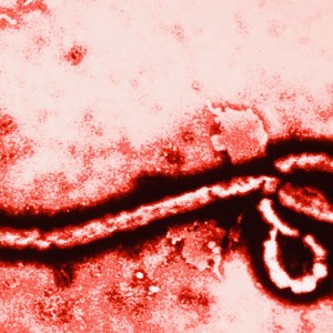 Ebola-Virus