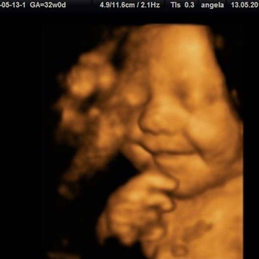 Ultrasound Captures Baby Smiling in the Womb | Christian News Network