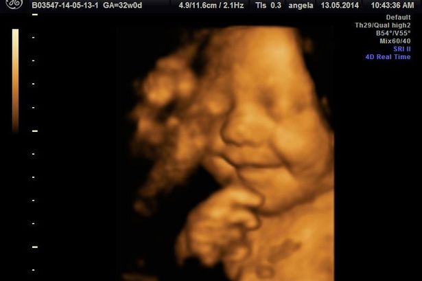 Ultrasound Captures Baby Smiling in the Womb