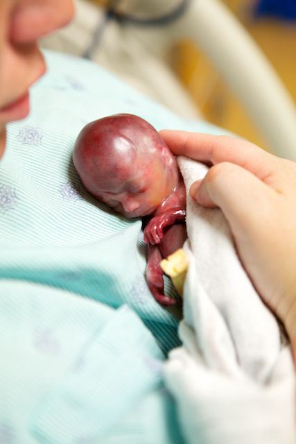 Photos of Baby Walter, Miscarried at 19 Weeks, Help Save Children from Abortion