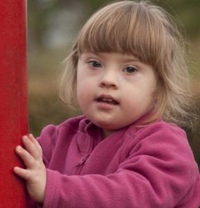 Down Syndrome Child-compressed