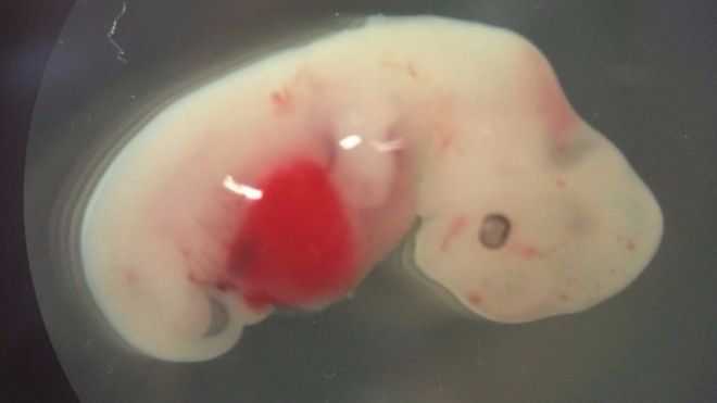 Researchers Experiment Creation of Human-Pig ‘Chimera Embryos’ to Address Shortage of Donor Organs