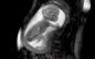 Georgia House bill 441 seeks to criminalize abortion, protect life