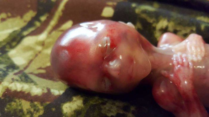Mother Shares Photos of ‘Perfectly, Wonderfully Formed’ Son Miscarried at 14 Weeks, Urges Women to Rethink Abortion