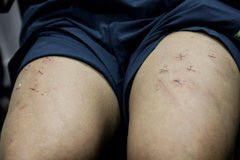 Kidnappers Staple Crosses in Legs of Hong Kong Christian