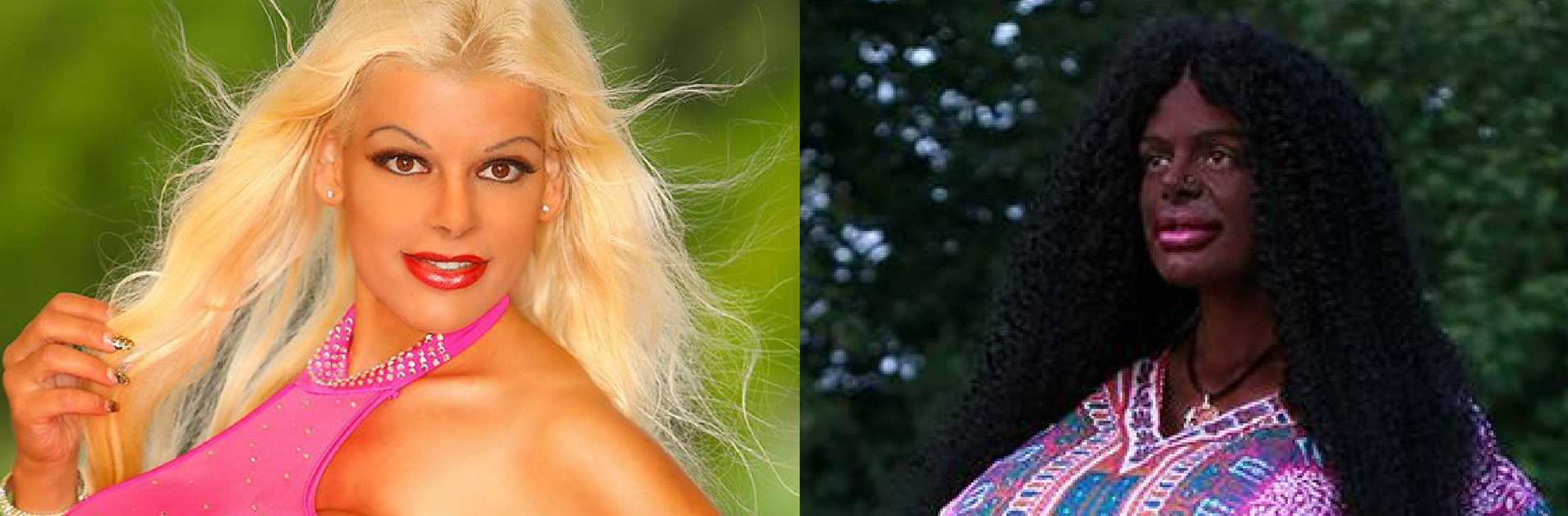 That Is My Race': 'Transracial' German Model Undergoes Treatments to ' Transition' From Caucasian to Black