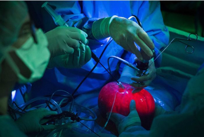To Mend a Birth Defect, Surgeons Operate on the Patient Within the Patient