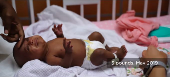 World’s Smallest Surviving Baby Goes Home from San Diego Hospital: ‘She’s a Miracle’