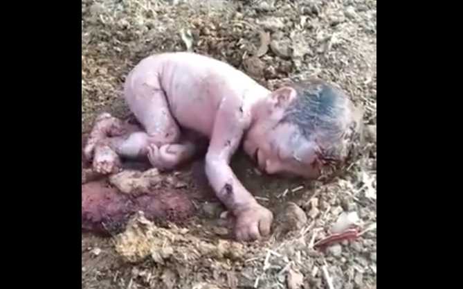 Newborn Baby Girl Abandoned in Indian Garbage Dump, Video of Child Leads Couple to Seek Adoption