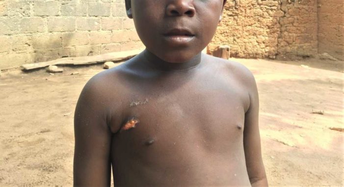 7-Year-Old in Nigeria: Herdsmen Shot Me and Killed My Uncle