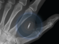 Implanted Microchip in Hand May Be Used to Verify COVID-19 Vax Status