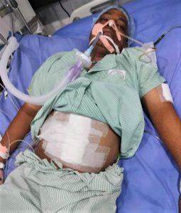 Pastor and taxi driver Sukhdev Mark was attacked in Haryana state, India on Sept. 15, 2022. (Morning Star News)