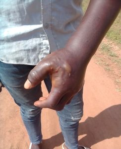Evangelist, other Christians in Uganda Assaulted