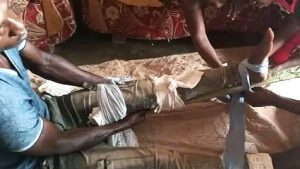 Muslim assailants broke Mukisa Siraji’s leg on May 28, 2024 near Iganga, Uganda. (Morning Star News)