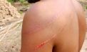 Tribal Men in India Assault Pastor, Family for their Faith