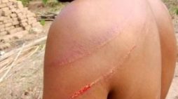Tribal Men in India Assault Pastor, Family for their Faith