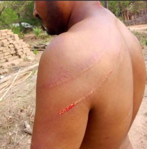 Pastor Motu Sodi was attacked with wooden sticks in Sukma District, Chhattisgarh state, India on April 13 and 14, 2026. (Morning Star News)